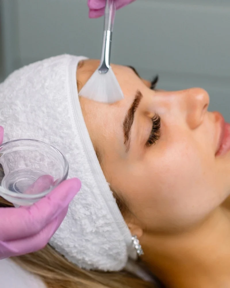 Peeling kwasowy Siedlce — peelingi chemiczne w Multi Kosmetyka